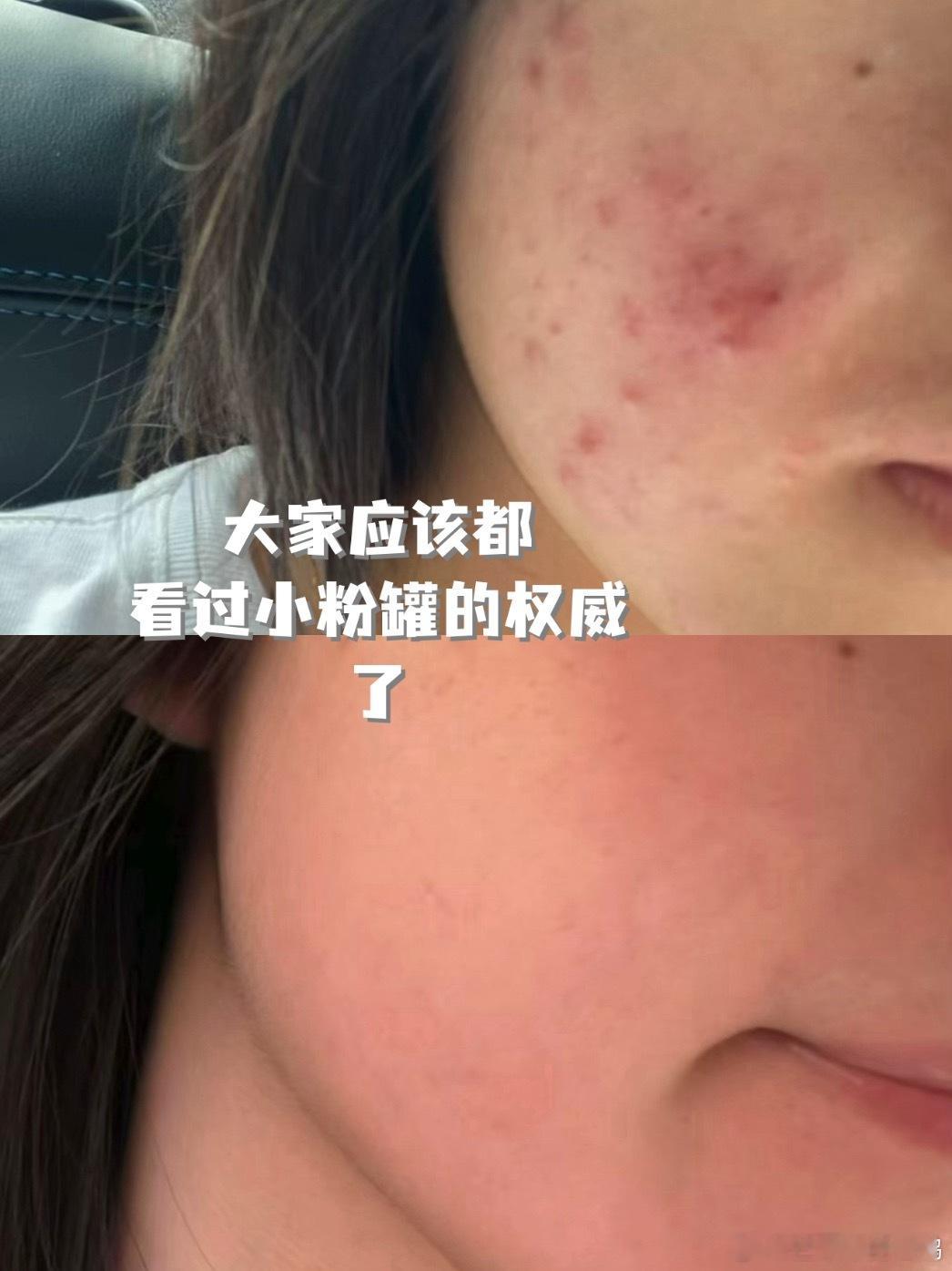 是的没错 小粉罐的礼盒和机制终于出来啦！！！本来想着手表是满赠送的 但是看见大家