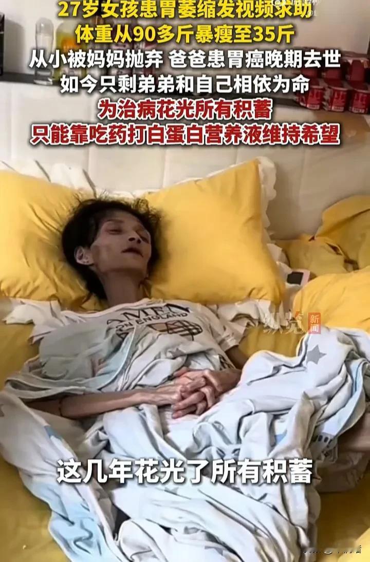 看着都心疼！7月27日，一名27岁女子发视频求助，表示自己患上胃萎缩，体重从90