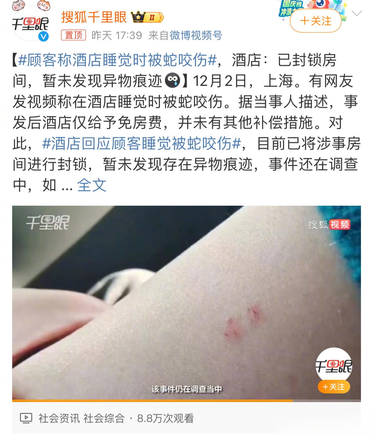 #顾客称酒店睡觉时被蛇咬伤#这位顾客手臂上伤口，是不是被蛇咬的？其实，专业人士一