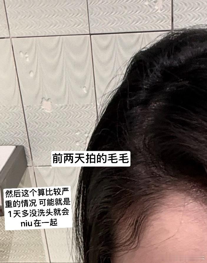 发现一个很好笑的事情，我的头发两边都有胎毛，因为我又自来卷，我的有一撮胎毛就一直