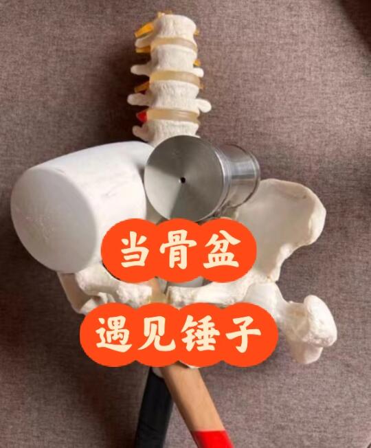 当骨盆遇到锤子