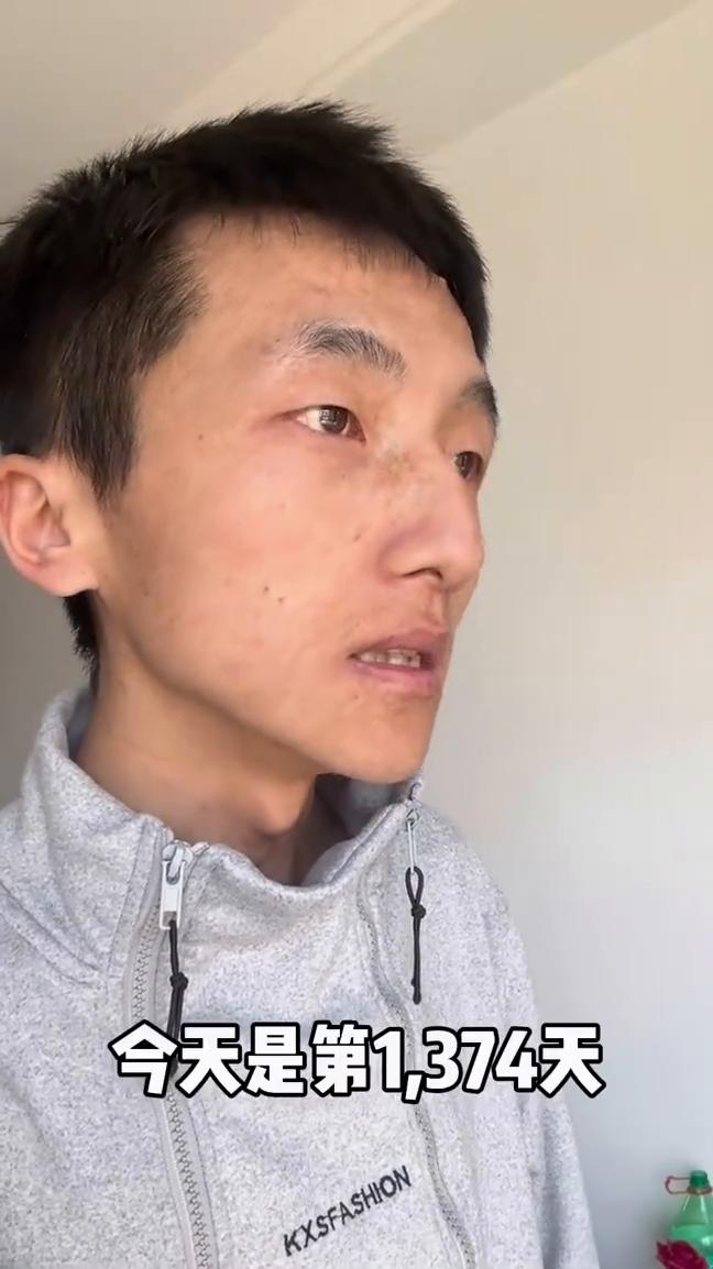 挑战一辈子不洗脸，今天是第1374天。绝对真实，绝对靠谱，绝对没毛病。