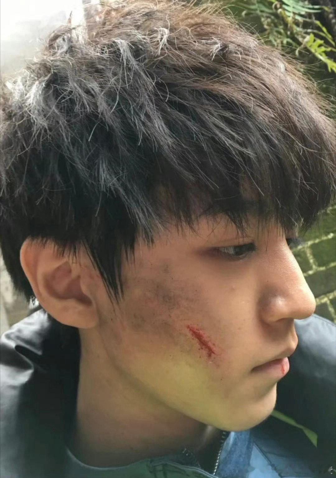 19岁的我，在成长的道路上不断探索与挑战。每一次跌倒都是对未来的铺垫，每一份伤痕
