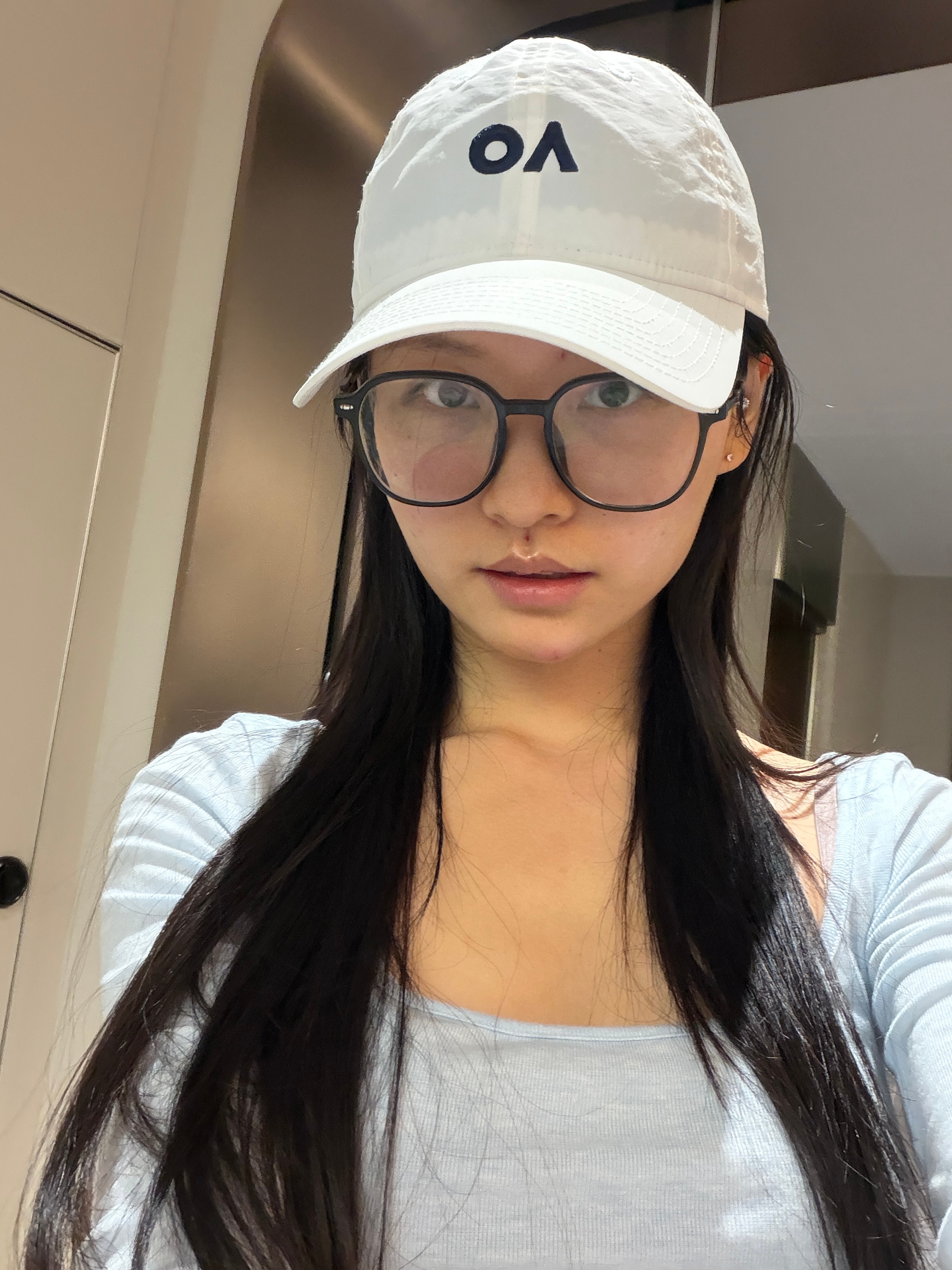 咋这么爱长闭口粉刺呢？？？ 