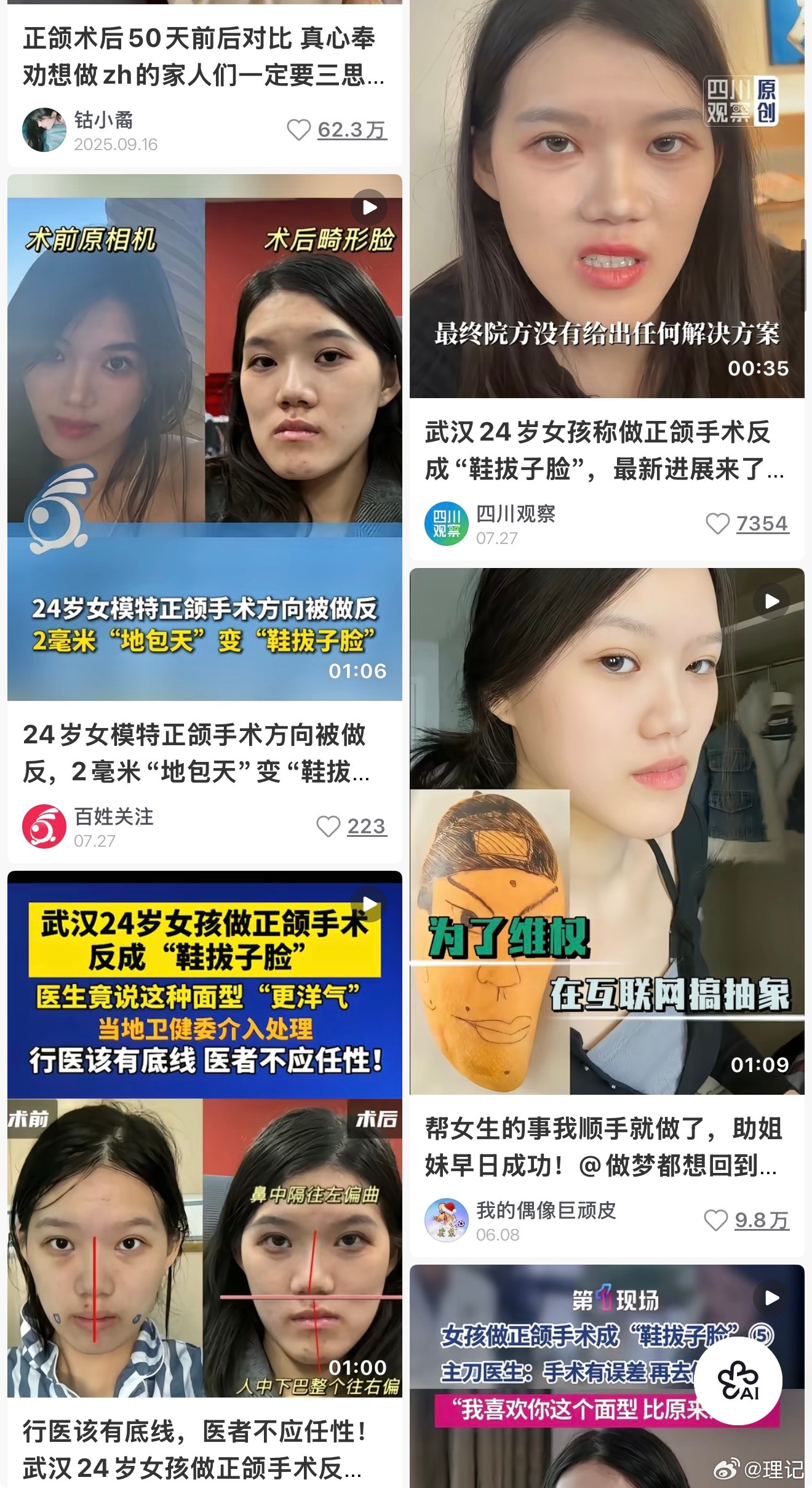 //根本就没做反，这个手术是正畸➕正颌，或者先正畸再正颌，或者正颌做完必须做正畸