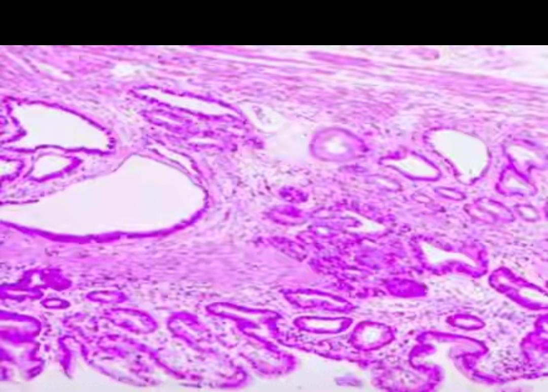 4次胃镜漏诊胃癌！医生戳破真相：不是检查没用，是你没选对方式！
 
真的吓出一身