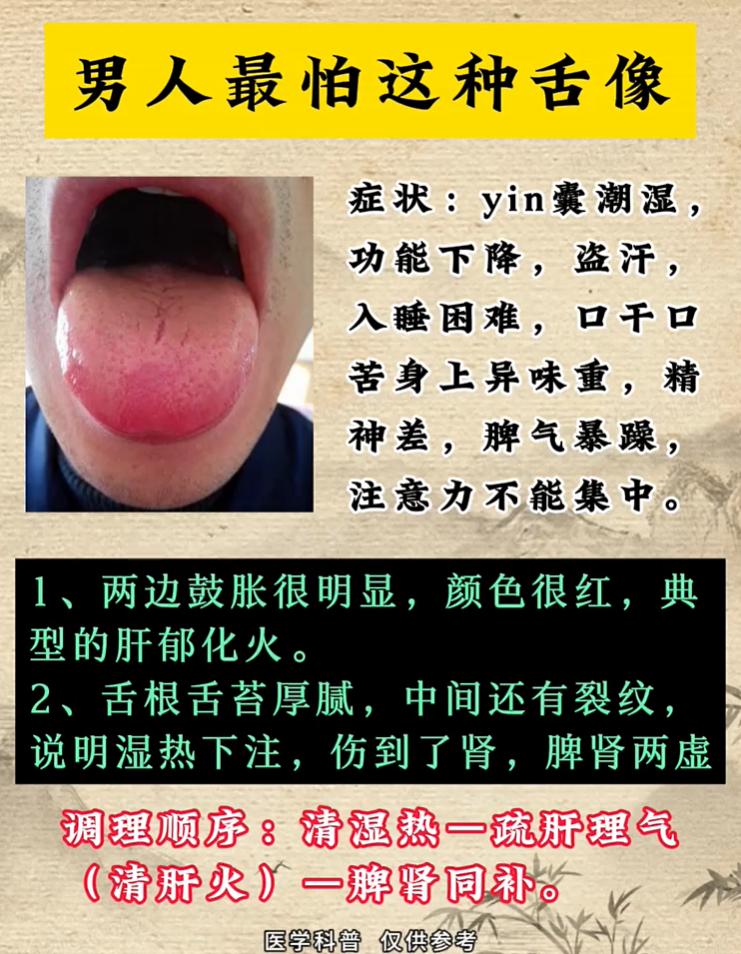 舌胀红伴舌根厚腻，湿热肝郁脾肾同虚调理法