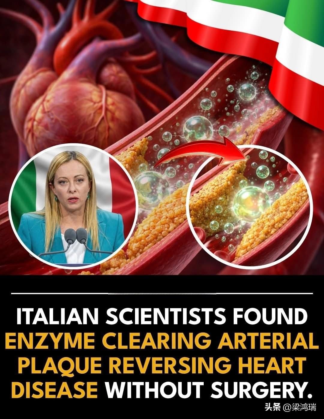 意大利米兰大学的研究人员发现，一种名为磷脂转移蛋白（PLTP）的酶能够有效地将胆