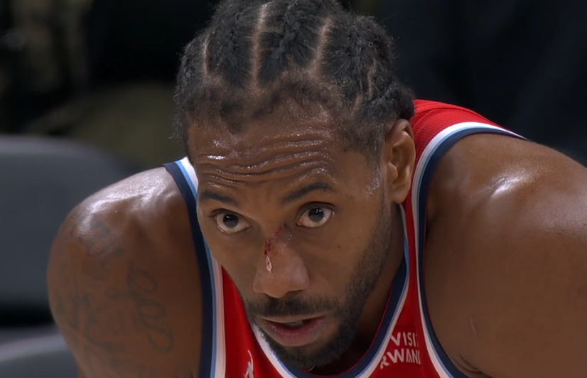 抄送阿米日鉴赏 