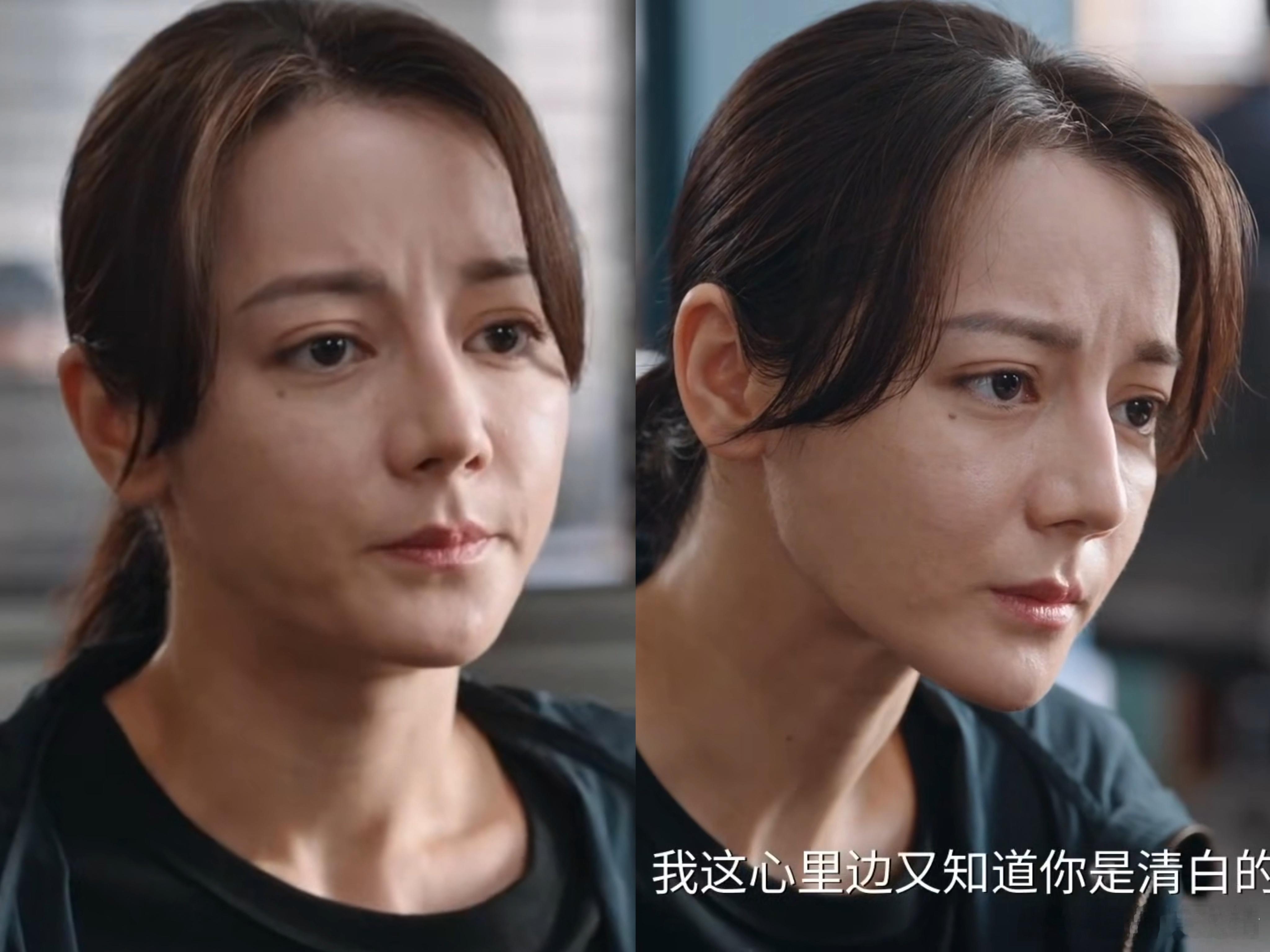 李登科说迪丽热巴没整容确实没整容，不过网友建议做做医美吧
