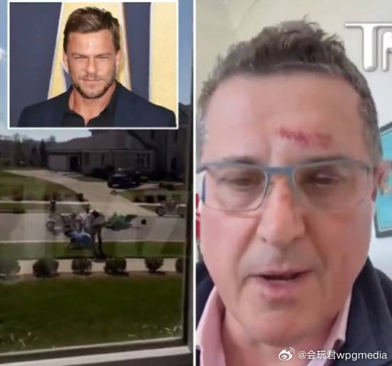 美国知名演员涉嫌殴打邻居 受害者曝光冲突全过程最新消息，因主演《侠探杰克》走红的