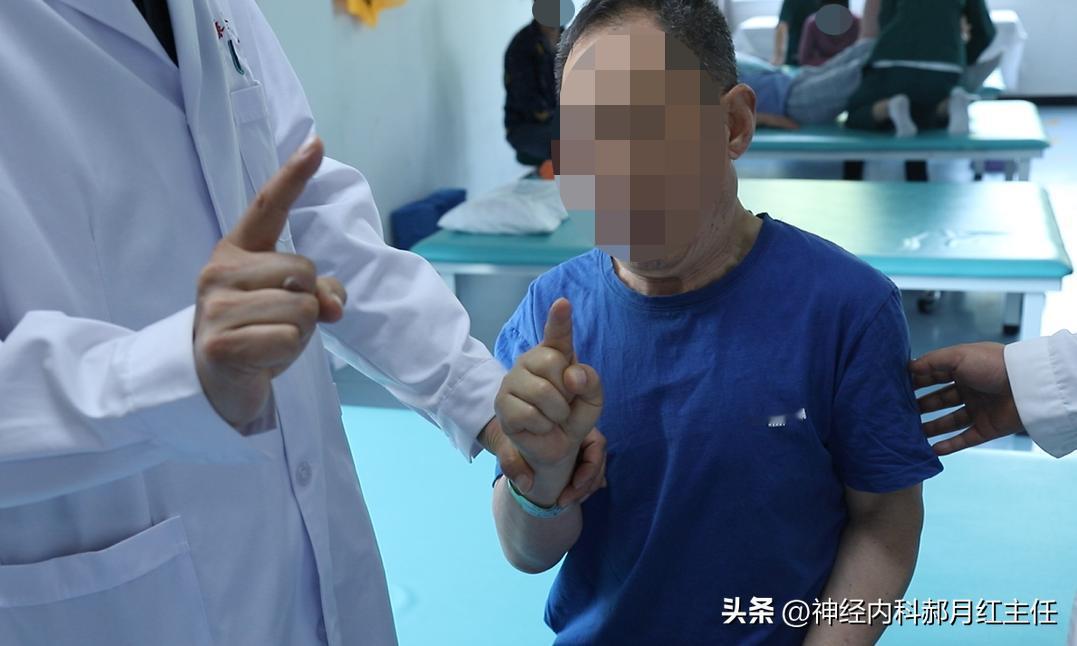 脑出血后遗症，视觉神经受损怎么恢复
 
脑出血后，可能由于血肿压迫，导致视神经受