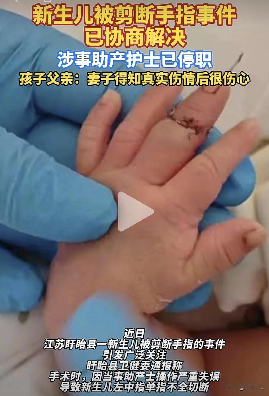 心碎！新生儿剪脐带竟遭误剪手指，神经难续！父亲拒绝10万赔偿：必须司法鉴定！最新
