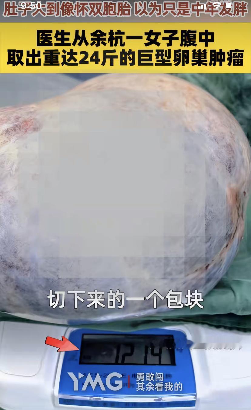 杭州一位40岁的何姐，差点被自己的肚子"骗"了命!
她平时不痛不痒，也从没做过妇