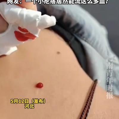 "这是啥原因？"河北，女子看到身上有个小疙瘩，一时没管住手就给抠破了，可紧接着就