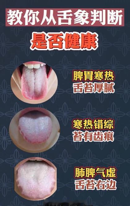 教你从舌象判断哪是否健康，看看自己是哪一种？
