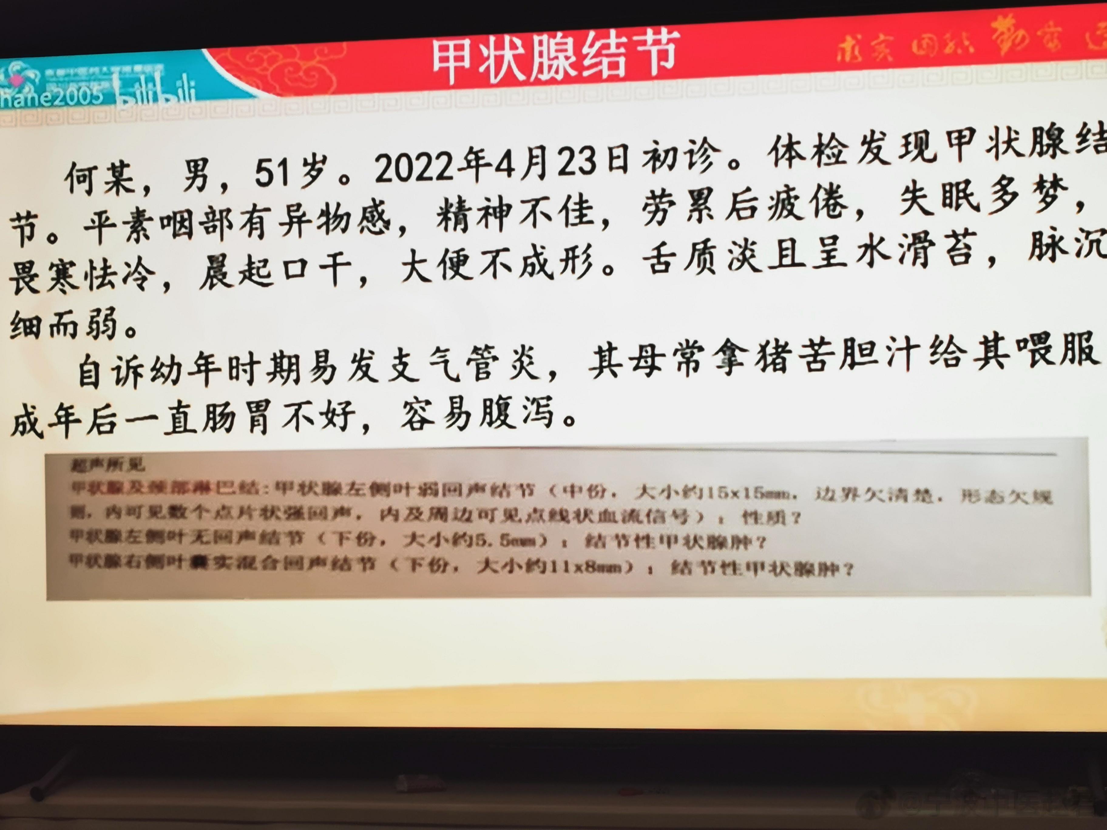 成都中医药大学附属医院岳仁宋教授治一甲状腺结节，华西考虑诊断4C类，建议穿刺，患
