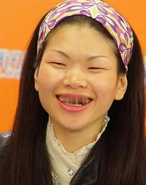 1999 年，吕燕 18 岁，带着满脸雀斑去面试模特，一个男人看到她说:“你真漂