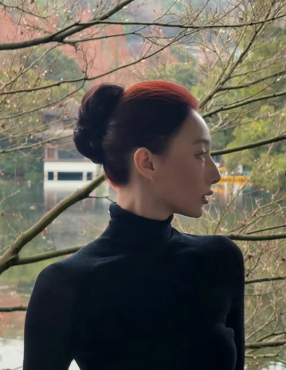 小雪自己原生脸本身就很好看，而且自己也很有气质，而且也只是打针也没有说其他的还是