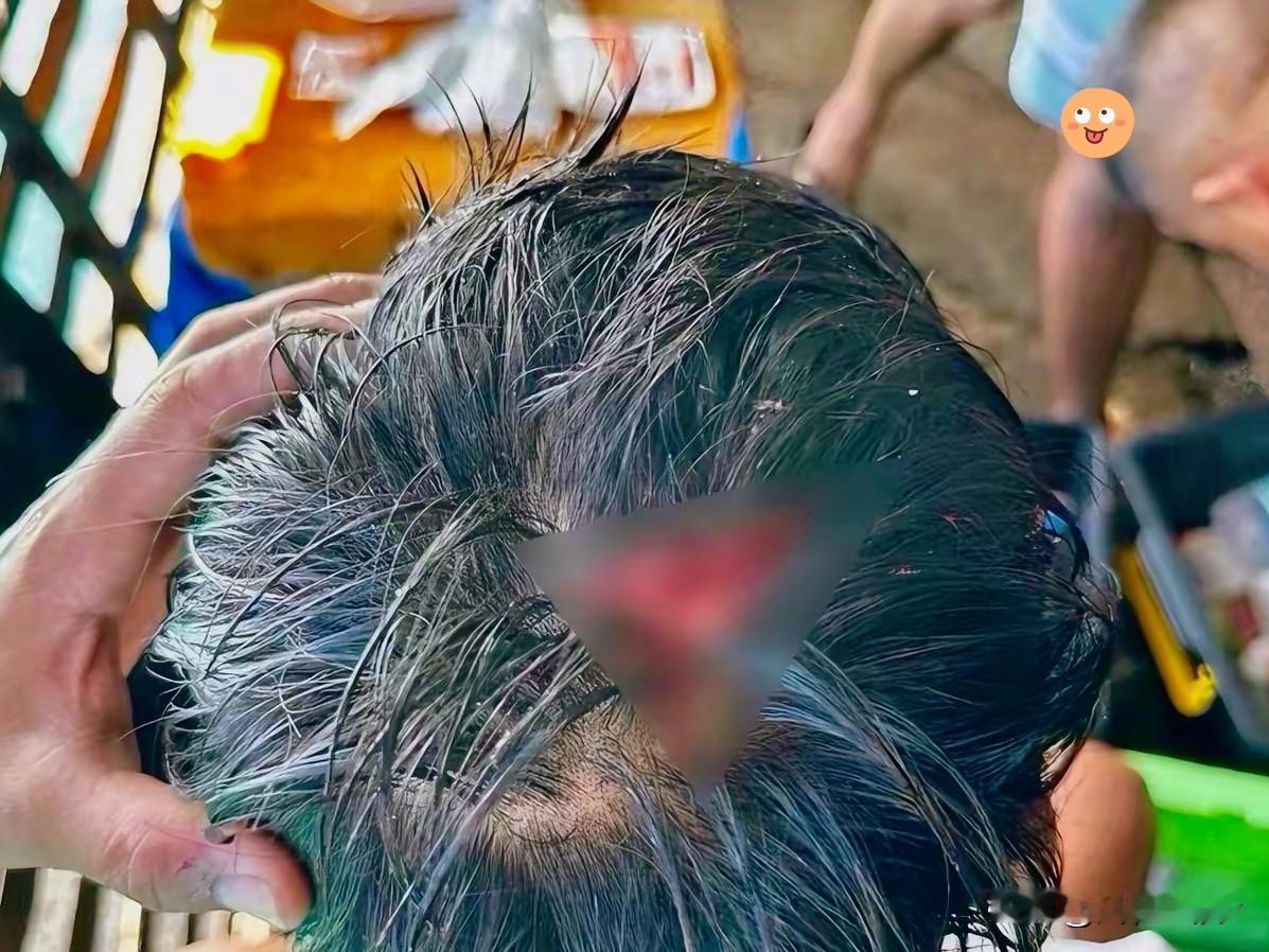 当场开瓢，菲律宾被揍了。
7月20日，菲律宾军方发布声明，一名菲律宾海军人员在南