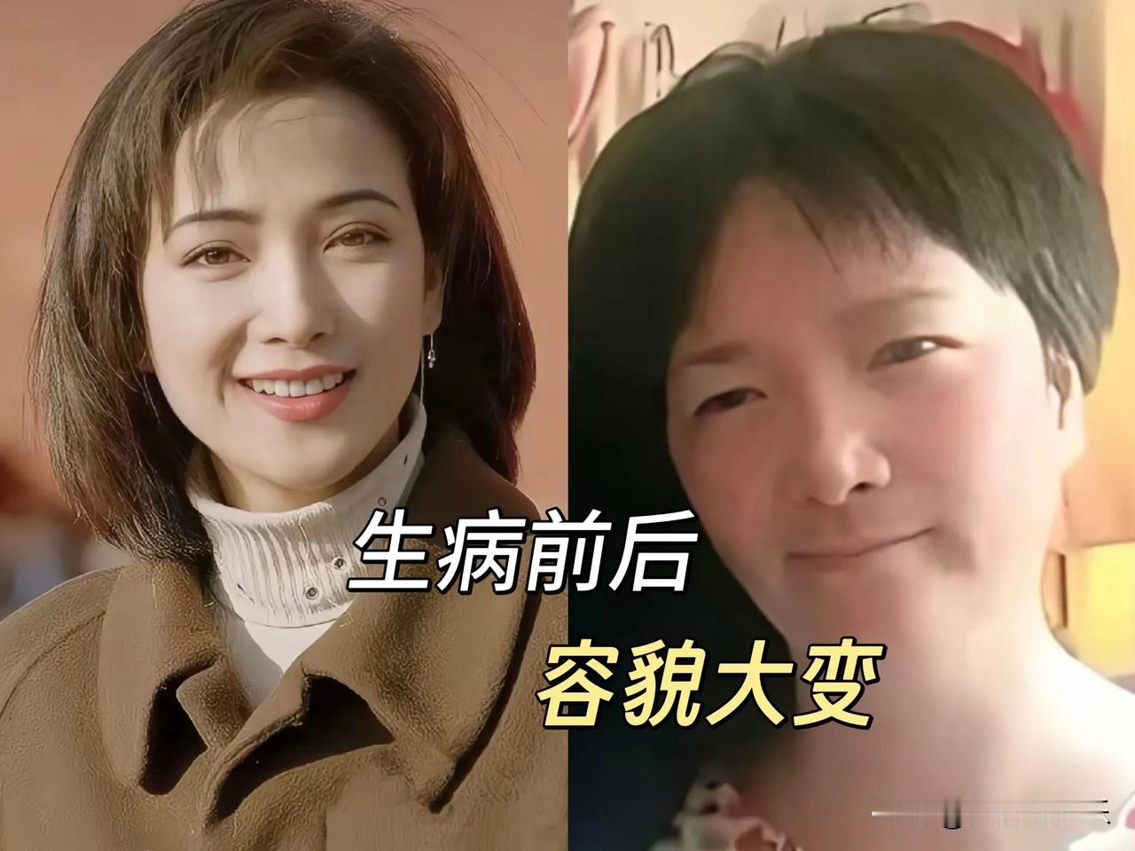 昨天和朋友聚餐，聊到女星何晴去世，她三甲医院的姐姐告诉她，女人过了40岁千万不要