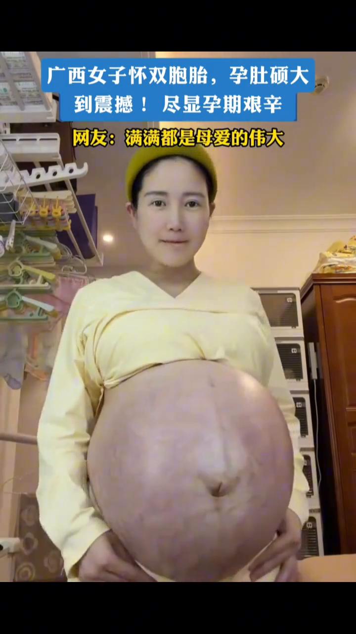 广西女子怀双胞胎，孕肚硕大到震撼！尽显孕期艰辛。网友：满满都是母爱的伟大。
4月
