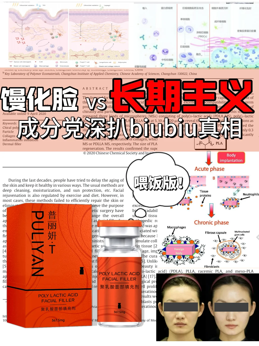 越打玻尿酸越垮？这才是疲态脸的解法！！！
