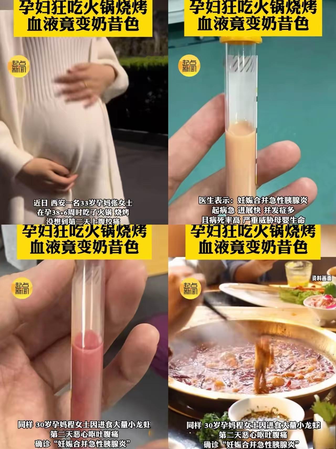 一觉醒来，怀孕的准妈妈们都沉默了！9月10日，西安的张女士已怀孕38周，因突然腹