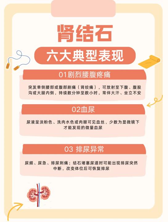 肾结石的 6 大典型症状，一定要警惕！