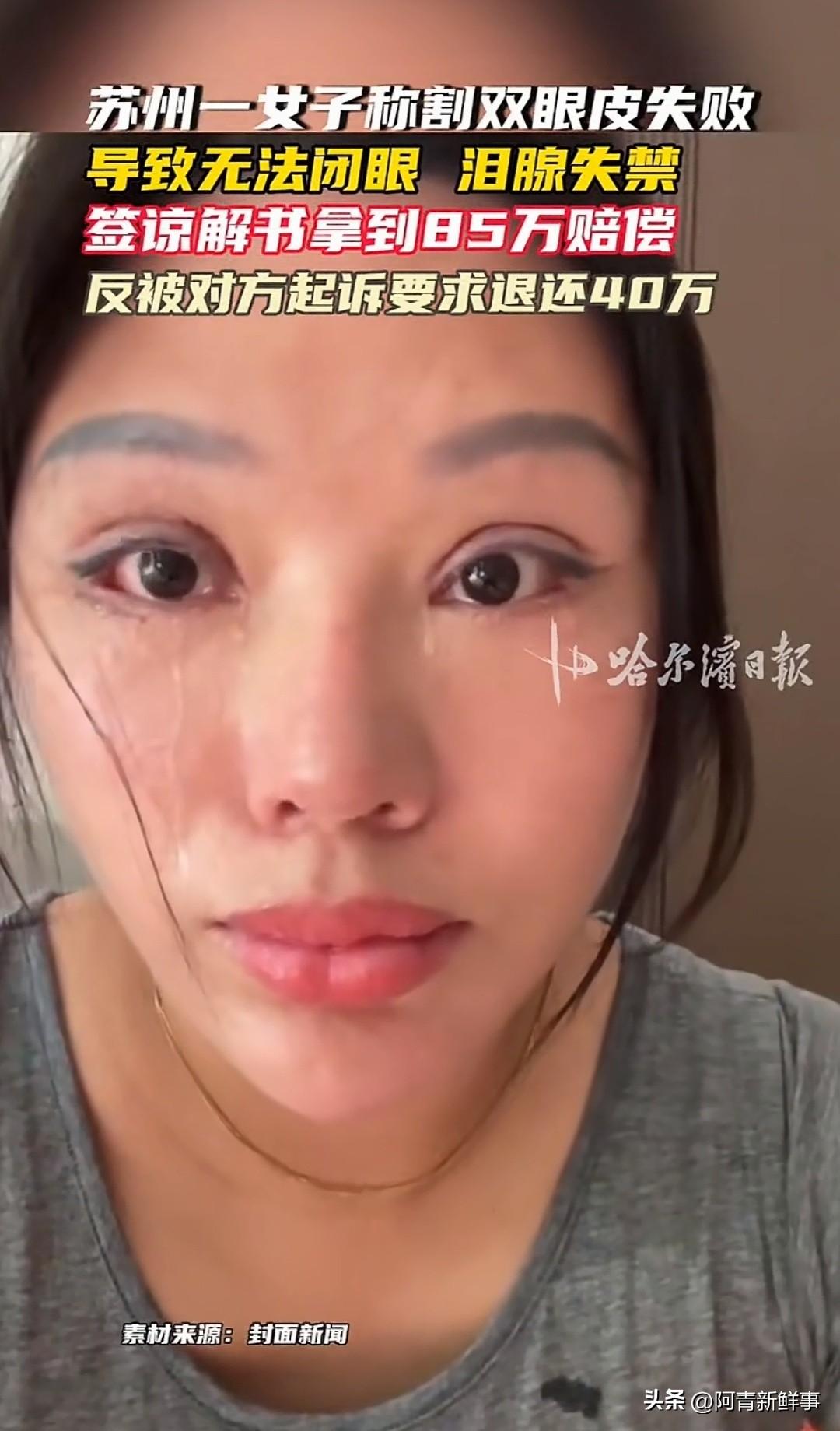 女子割双眼皮被割成九级伤残，非法行医的老板只判了6个月拘役。结果老板反手把受害者