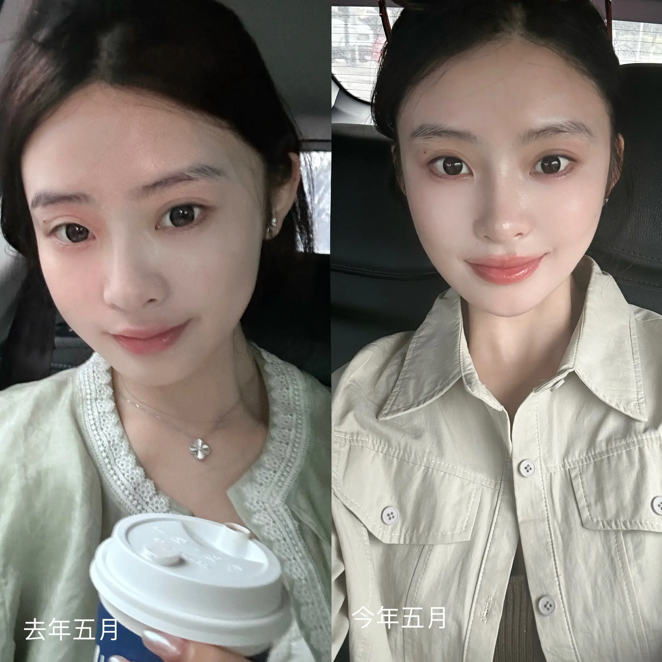 一年一度的状态复盘 骨相抗衰好像有点用。抗衰