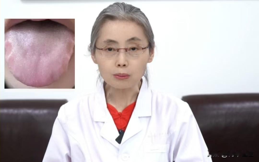 这个舌头，看似繁杂，但只要这四点不忽视，就很好调！

患者主诉：宗筋无力，时间短
