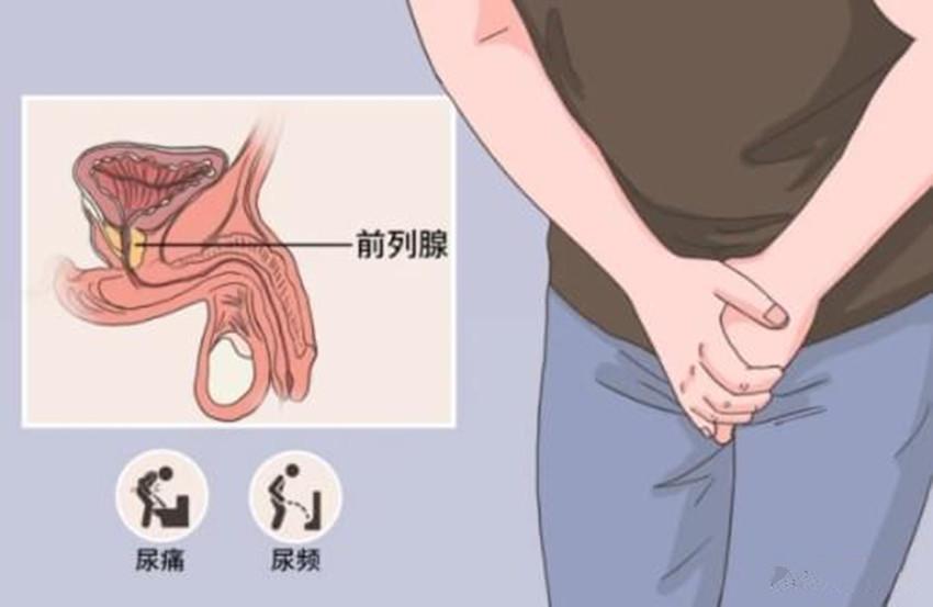 前列腺增大有哪些影响？有什么害处？

前列腺增大的问题应该说很多男性并不会感到陌