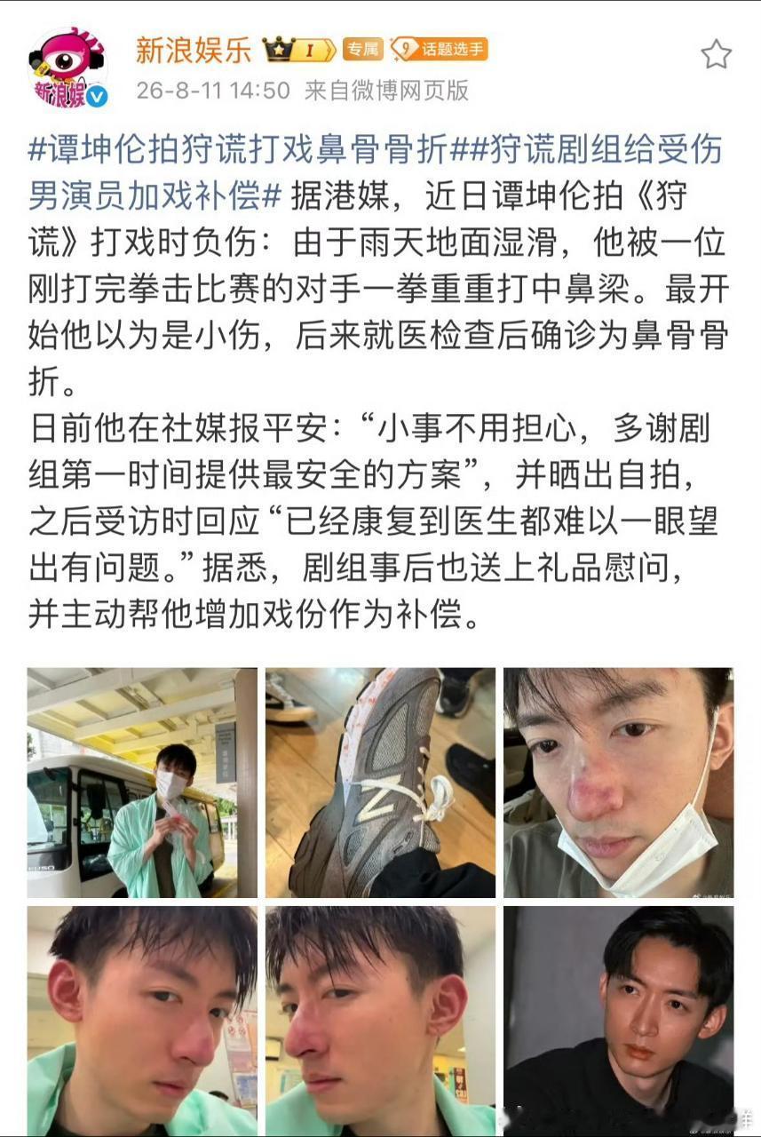 这剧组怎么又有人受伤了加戏补偿倒是第一次听说