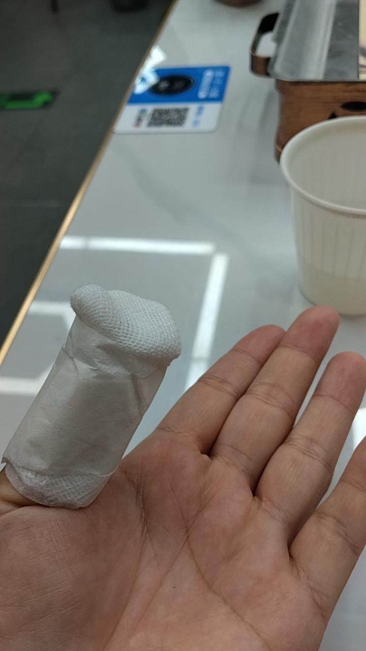 手受伤了，才发现有多么不方便，儿子说，妈妈，如果我不买椰子，你就不会受伤了！看着