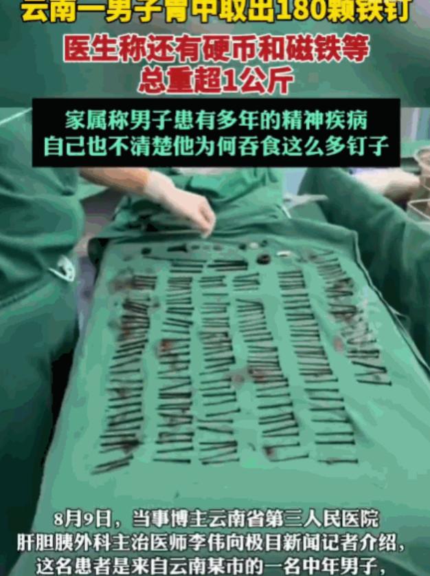 解释不清了！8月9日消息，云南一男子反复腹痛、呕吐送医，医生检查后都看懵了：他的