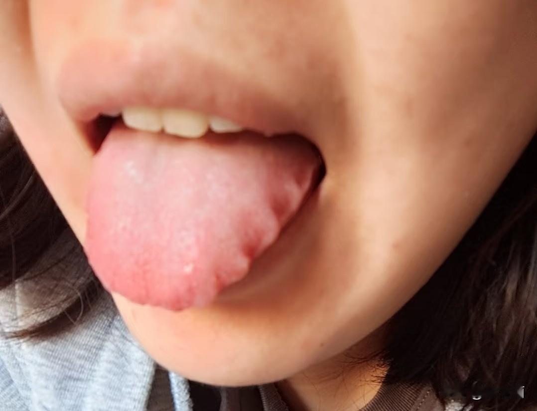 表妹的舌头有锯齿的感觉，她问我像不像恐龙的舌头。后来我上网查了一下这种舌头，不查