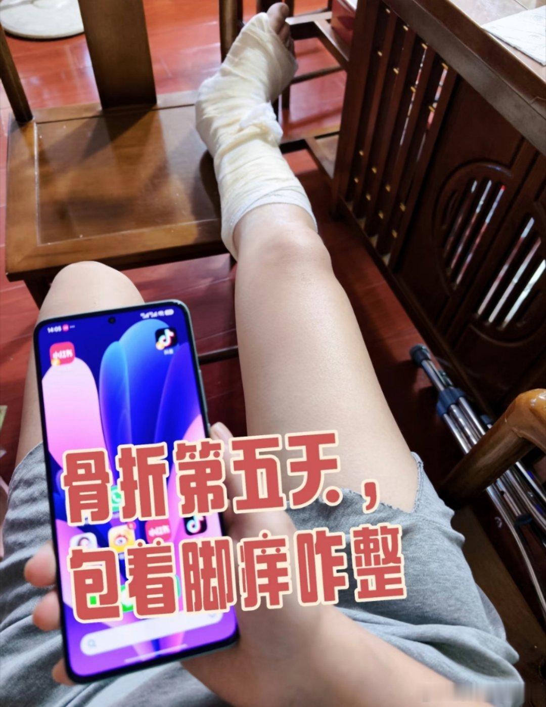 今天第五天了，还不忘忙工作，这下包着小腿的位置有点痒，还要包好久，这可咋整啊[允
