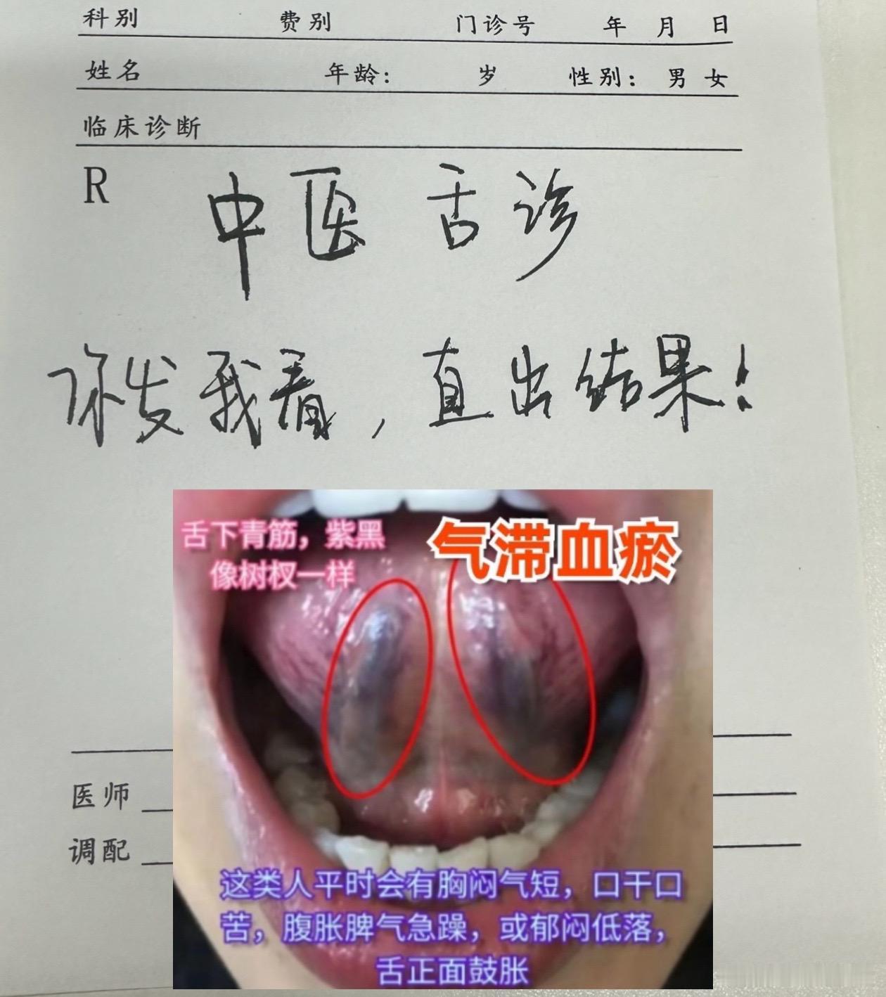 中医舌诊，继续进行中