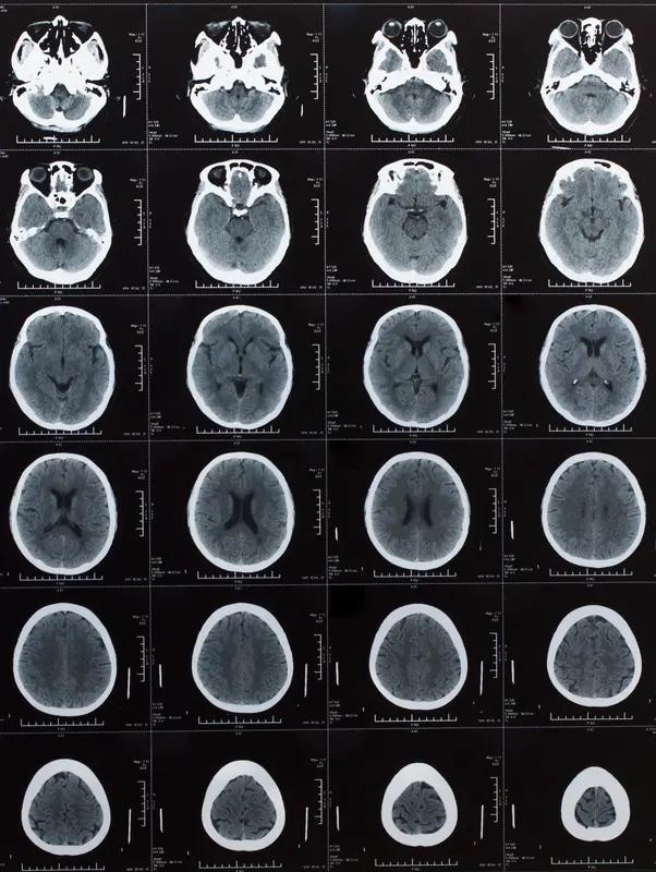 宝妈晒娃本是分享日常，没想到被网友催着就医，结果孩子确诊脑积水，这剧情反转得让人