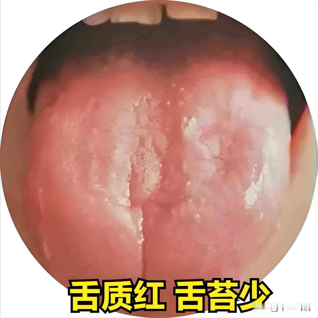 精血亏虚眼先知！精虚眼睛花，血虚眼睛干，这样做，补血填精不在话下！
①精虚眼睛花