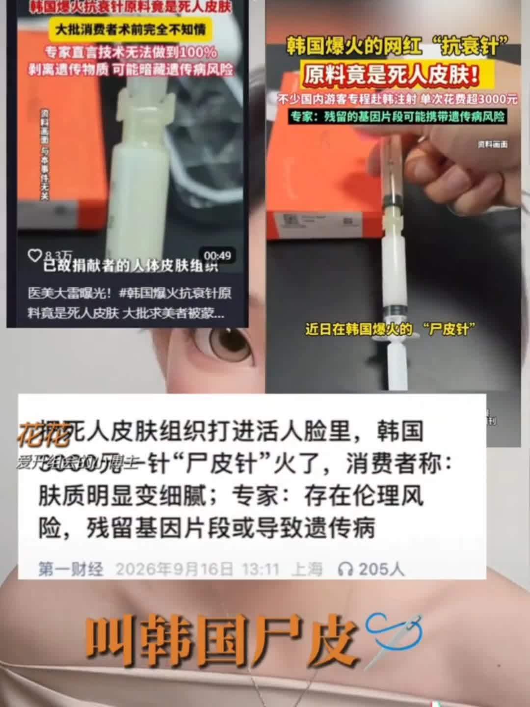 香港查获多支尸皮针香港卫生署10月20日在尖沙咀旺角荃湾元朗四间美容处所搜出17