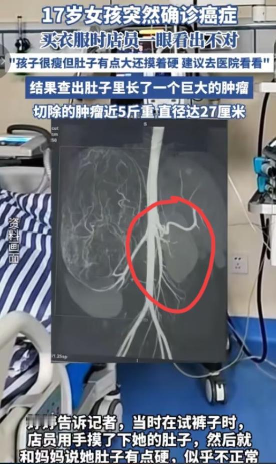 “幸亏发现了！”广东17岁女孩跟着妈妈去逛街，店员给女孩一条裤子试穿，可女孩穿上