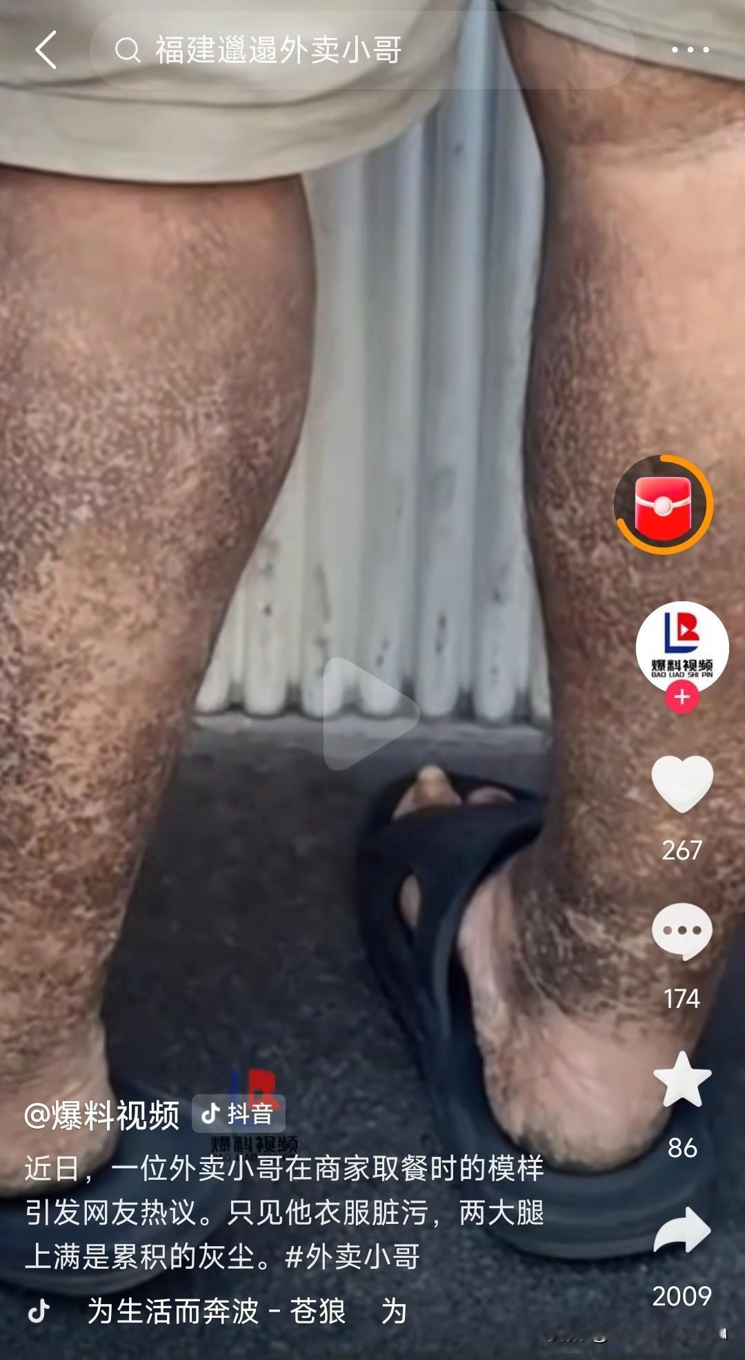 这么脏外卖员给你送餐你敢吃吗？他是真的单纯脏而已，绝对不是身体生病。包浆都可以防