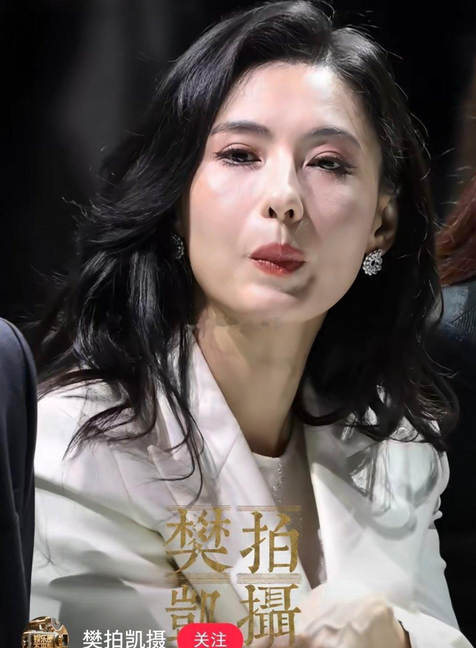 如果填充馒化就一定无药可救，那张柏芝呢，他之前有过填充肿的时期，现在也很自然了太