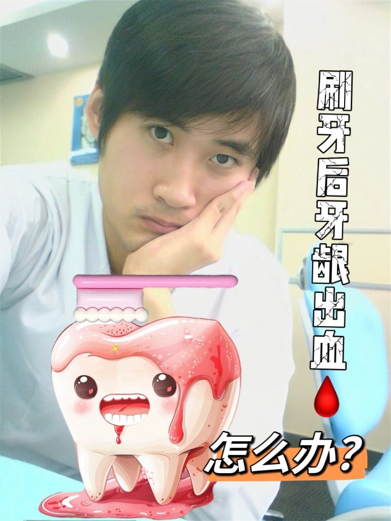 日常处理刷牙偶然出血的小妙招？