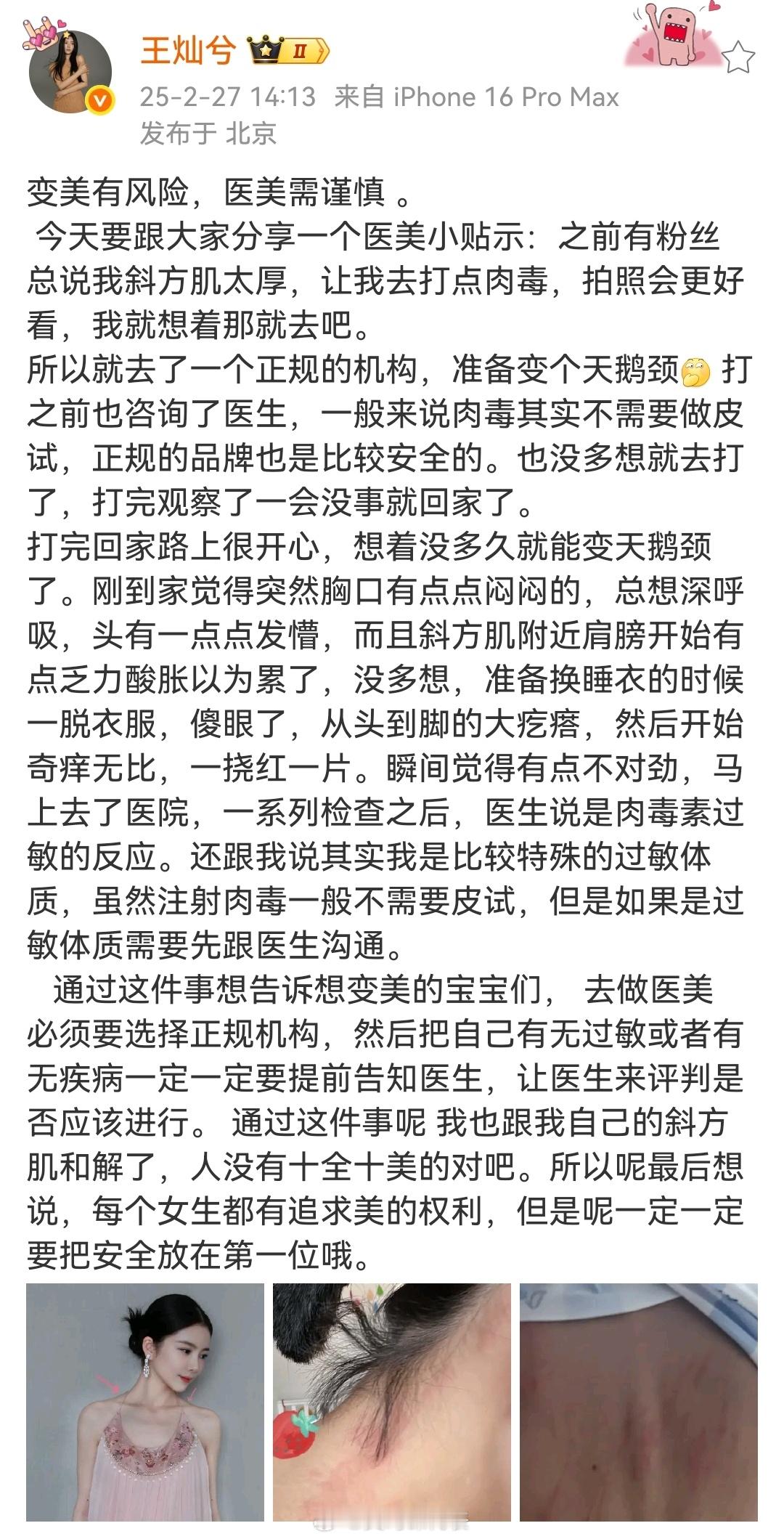 杜淳老婆打肉毒过敏  杜淳老婆自曝打肉毒过敏  杜淳老婆打肉毒全身过敏 