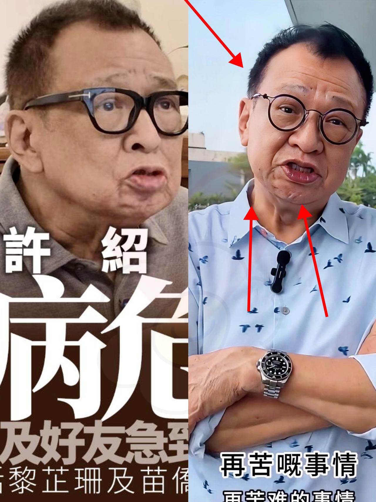 欢喜哥许绍雄去世了
让他放不下的
不是他的老婆龙嬿，也不是他的女儿许惠箐，而是他