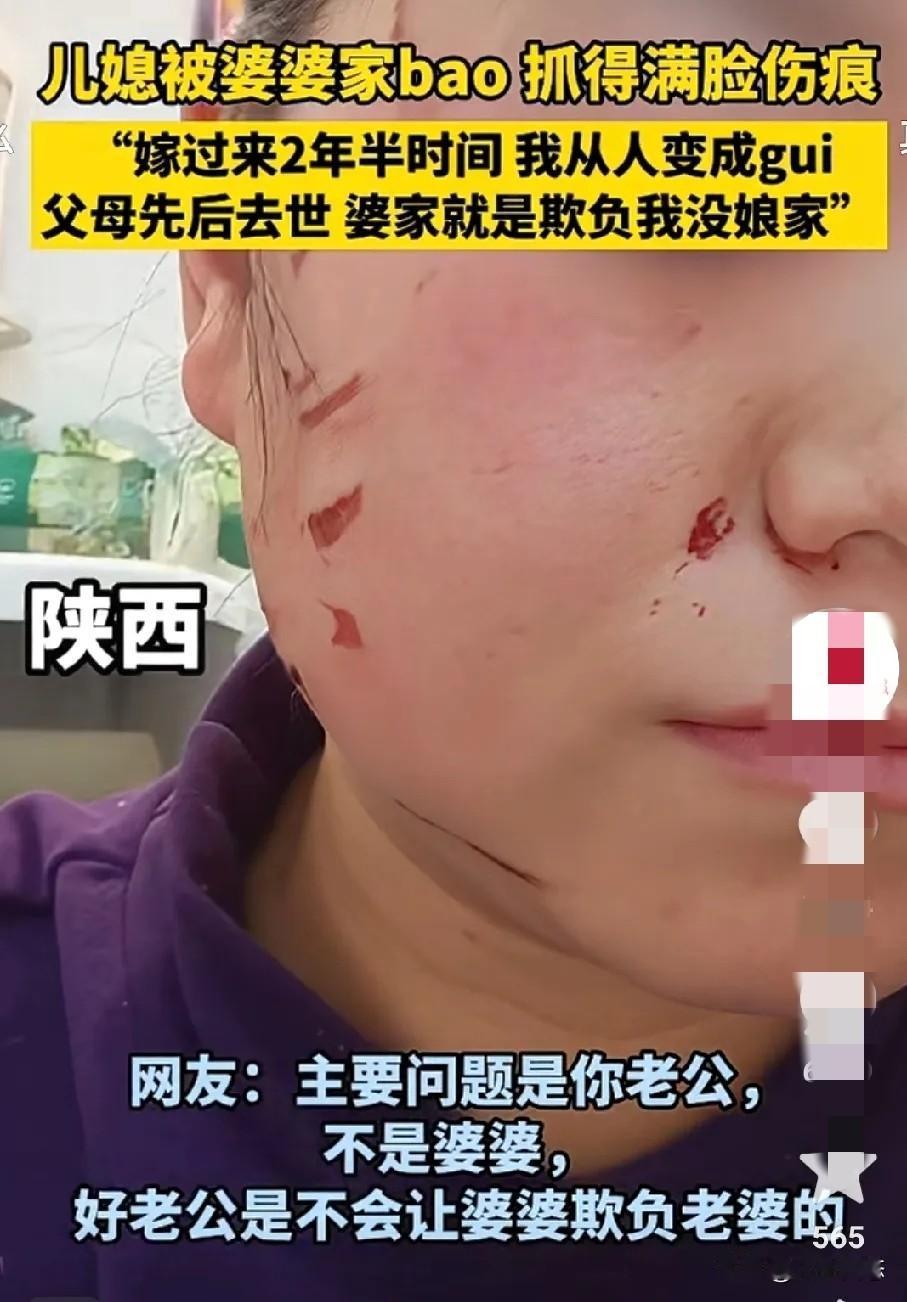 婆婆动手，老公不管！儿媳满脸抓痕哭诉：父母双亡，娘家已无人

看着她满脸的伤痕和