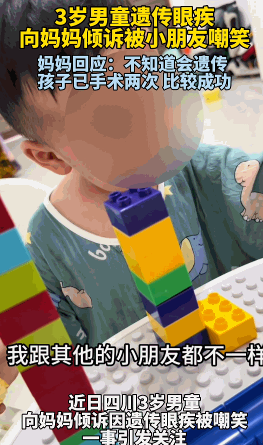 恶语伤人六月寒！四川，一名 3 岁小男孩 “小汤圆”，只因遗传父亲患上小睑裂综合